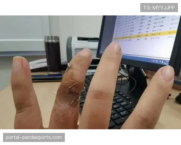 山东外援克里斯手指骨裂预计缺席三周，四月下旬有望复出